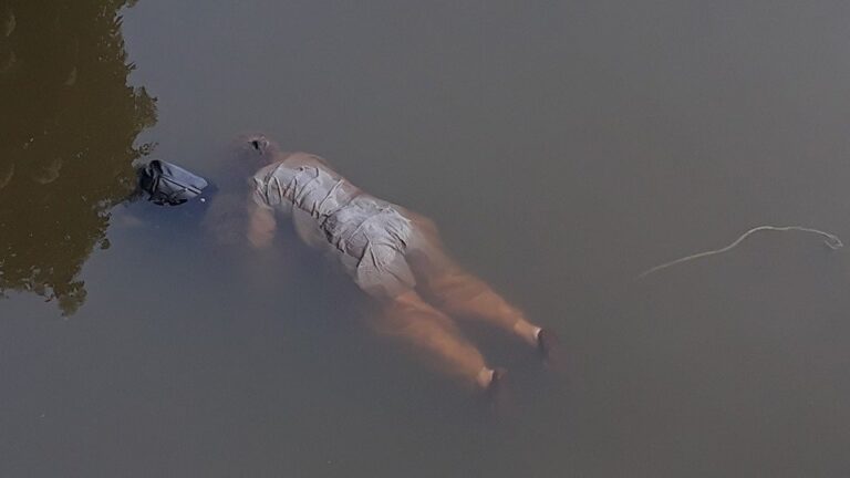 Dead body