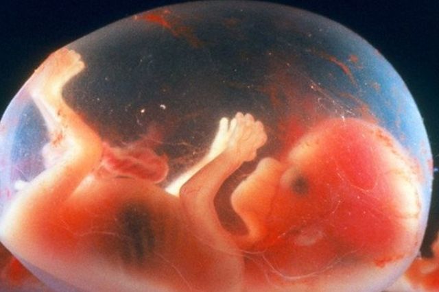 Fetus